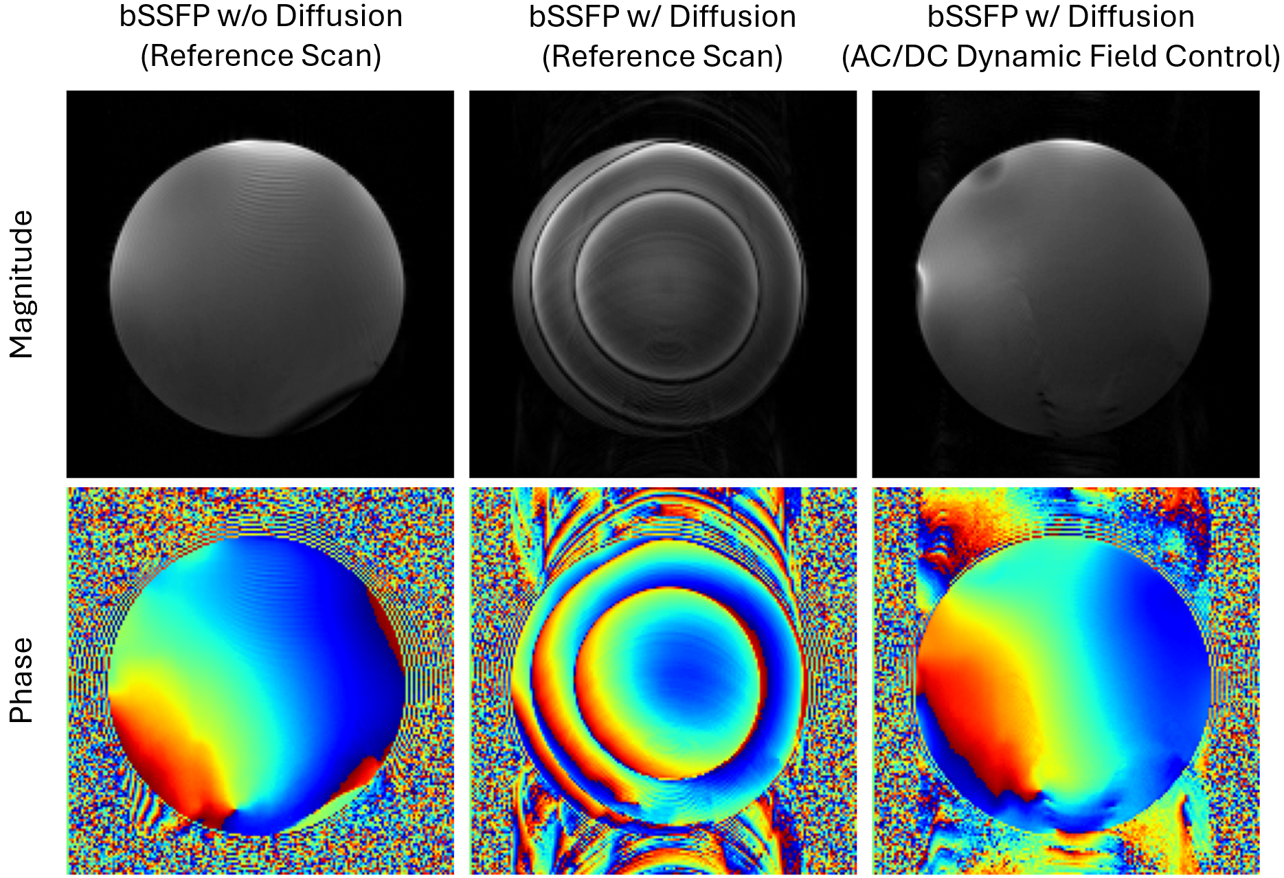Diffusion bSSFP Concomitant Field Compensation